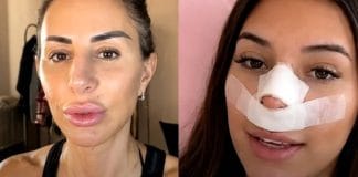 Influenceriță s-a operat. Motivul ei e complet absurd Influenceriță s-a operat. Motivul ei e complet absurd